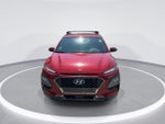 2021 Hyundai Kona Ultimate